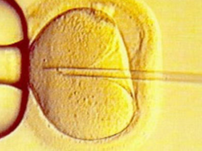 患有卵巢巧克力囊肿能做试管婴儿吗?